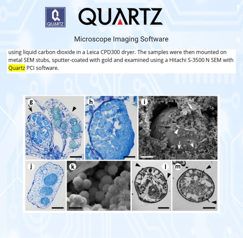 SEM micrograph of Marinomyxa parasite resting spores in Halophila seagrass, captured with Quartz PCI